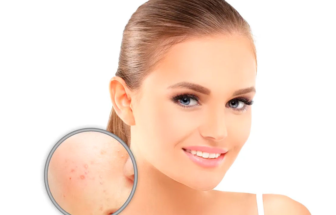 Skin pigmentation